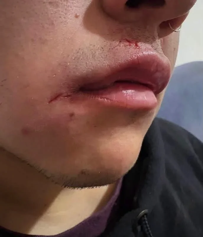 Denuncias de agresiones en el boliche Club G: un joven relata su experiencia