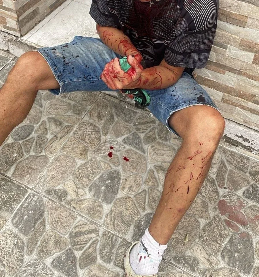 Violencia en el macrocentro: tres agresores atacan a un joven con machetes